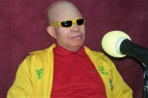 Texas Mwimba : une vie consacrée à la défense des personnes atteintes d’albinisme