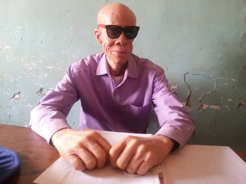 Israël Kajingu, défenseur des personnes vivant avec albinisme